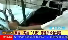 变性手术视频,真实记录与心理转变